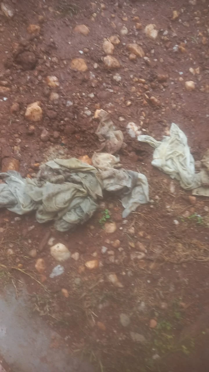 Wet wipes and cloth-like blockage material removed during a blocked toilet clearing job.